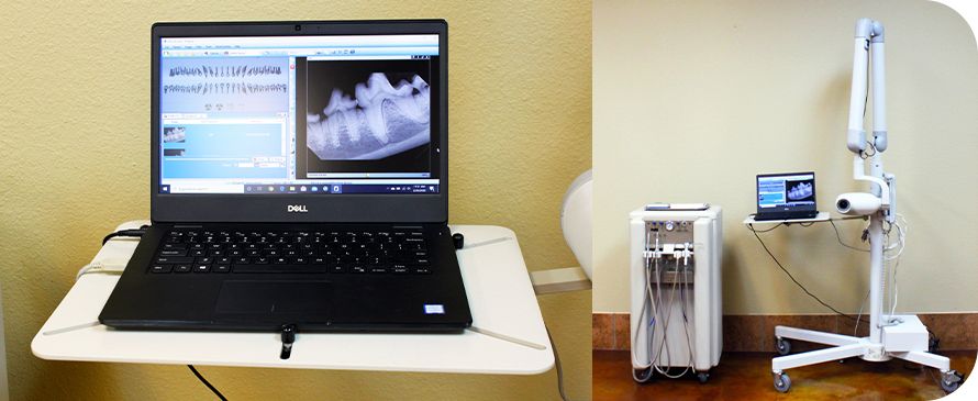 Laptop displaying dental X-rays, and a dental X-ray machine with monitor.